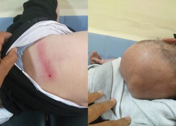 اعتداء شنيع على تاجر سمك بميناء العيون.