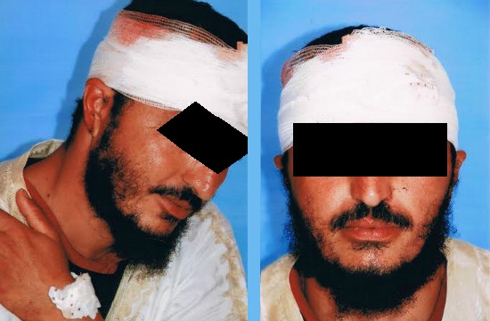 مهنيو الصيد البحري بطانطان يحذرون من استمرار تدهور الوضع الأمني بميناء طانطان