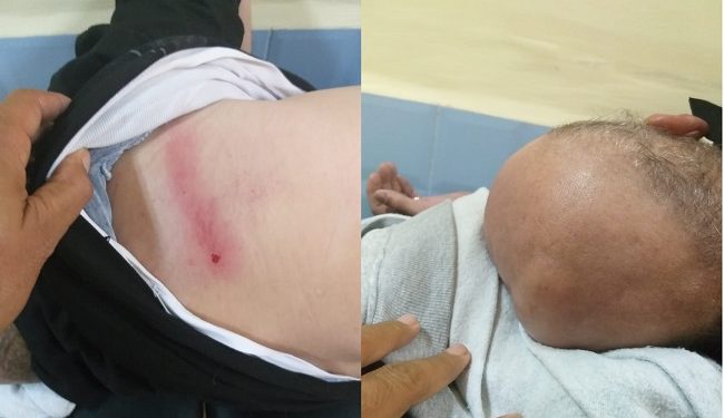 اعتداء شنيع على تاجر سمك بميناء العيون.